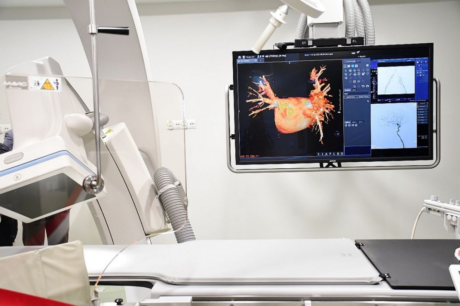 Zdjęcie w galerii na portalu naszwodzislaw.com: Śląsk stawia na nowoczesną diagnostykę nowotworową wiadomości z regionu