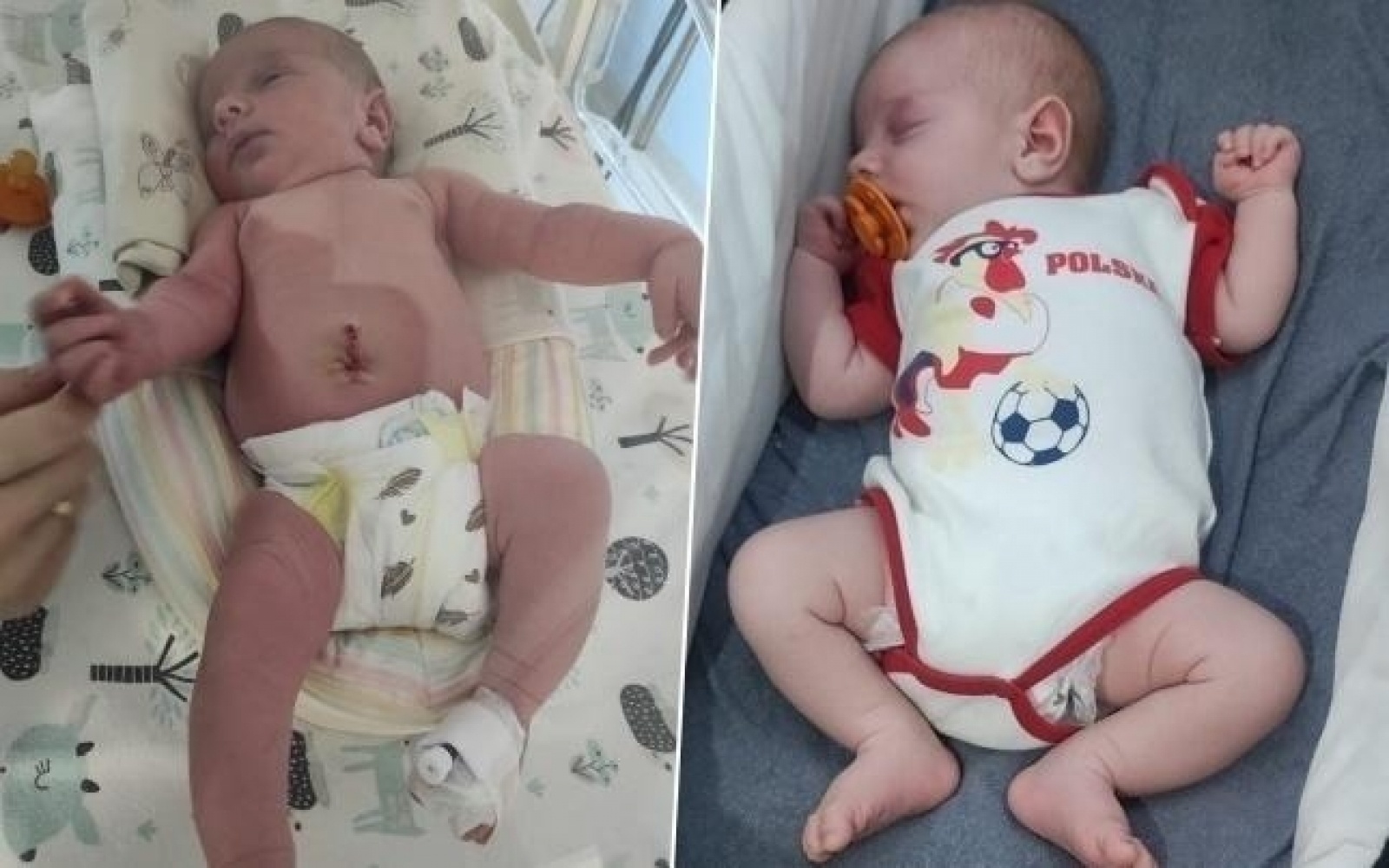 Zdjęcie w galerii na portalu naszwodzislaw.com: Podaruj życie Mikołajowi choremu na SMA wiadomości z regionu