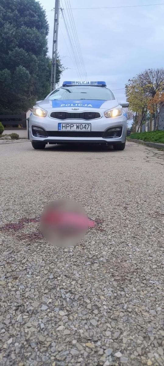 Zdjęcie w galerii na portalu naszwodzislaw.com: Chwila nieuwagi zakończona upadkiem wiadomości z regionu