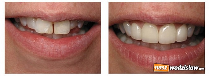 Zdjęcie w galerii na portalu naszwodzislaw.com: Sposób na piękny uśmiech wiadomości z regionu