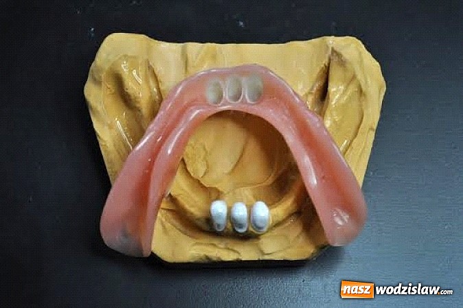 Zdjęcie w galerii na portalu naszwodzislaw.com: Protezy teleskopowe – idealne rozwiązanie dla wymagających pacjentów wiadomości z regionu