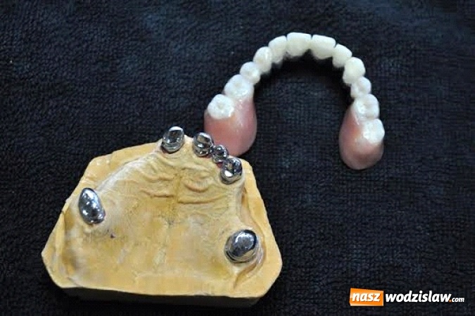 Zdjęcie w galerii na portalu naszwodzislaw.com: Protezy teleskopowe – idealne rozwiązanie dla wymagających pacjentów wiadomości z regionu