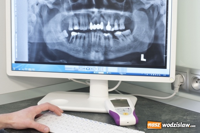 Zdjęcie w galerii na portalu naszwodzislaw.com: Bolesne znieczulenie u stomatologa? To już przeszłość! wiadomości z regionu