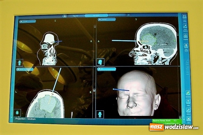 Zdjęcie w galerii na portalu naszwodzislaw.com: Neuronawigacja dostępna na Śląsku wiadomości z regionu