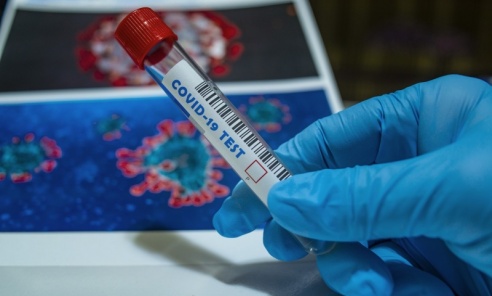 NFZ: od 1 kwietnia zmienią się zasady zlecania i wykonywania testów na koronawirusa - Serwis informacyjny z Wodzisławia Śląskiego - naszwodzislaw.com