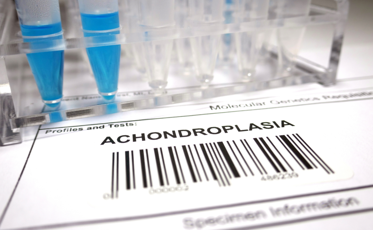 Co z lekiem na achondroplazję? Rzeczniczka Praw Dziecka pyta resort zdrowia - Serwis informacyjny z Raciborza - naszraciborz.pl