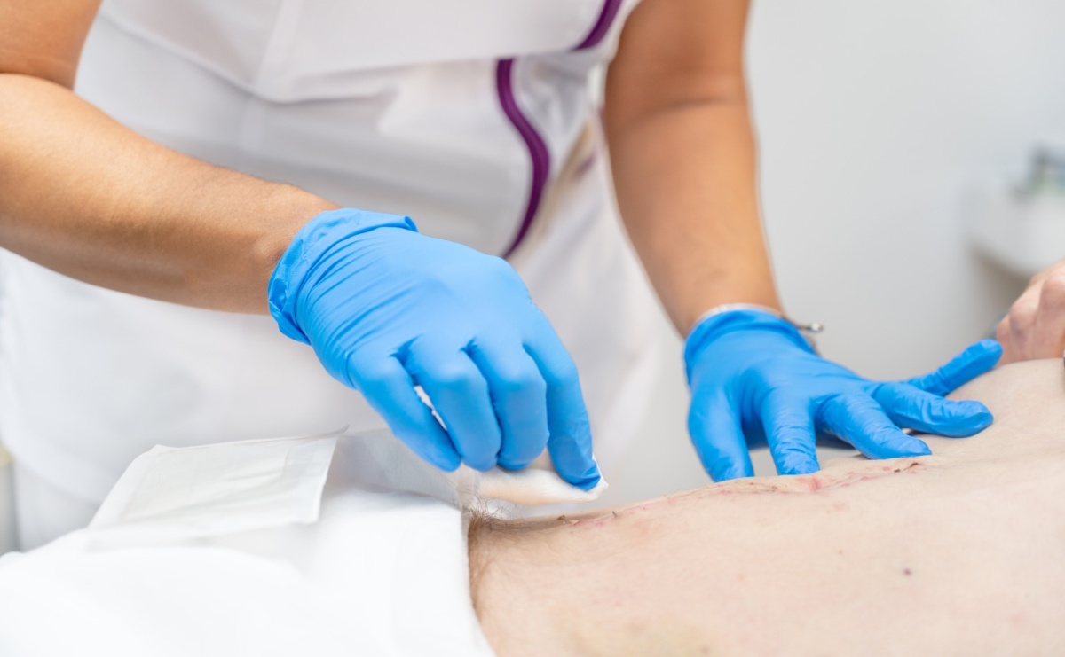 Jak dbać o ranę po zabiegu chirurgicznym? - Serwis informacyjny z Wodzisławia - naszwodzislaw.com