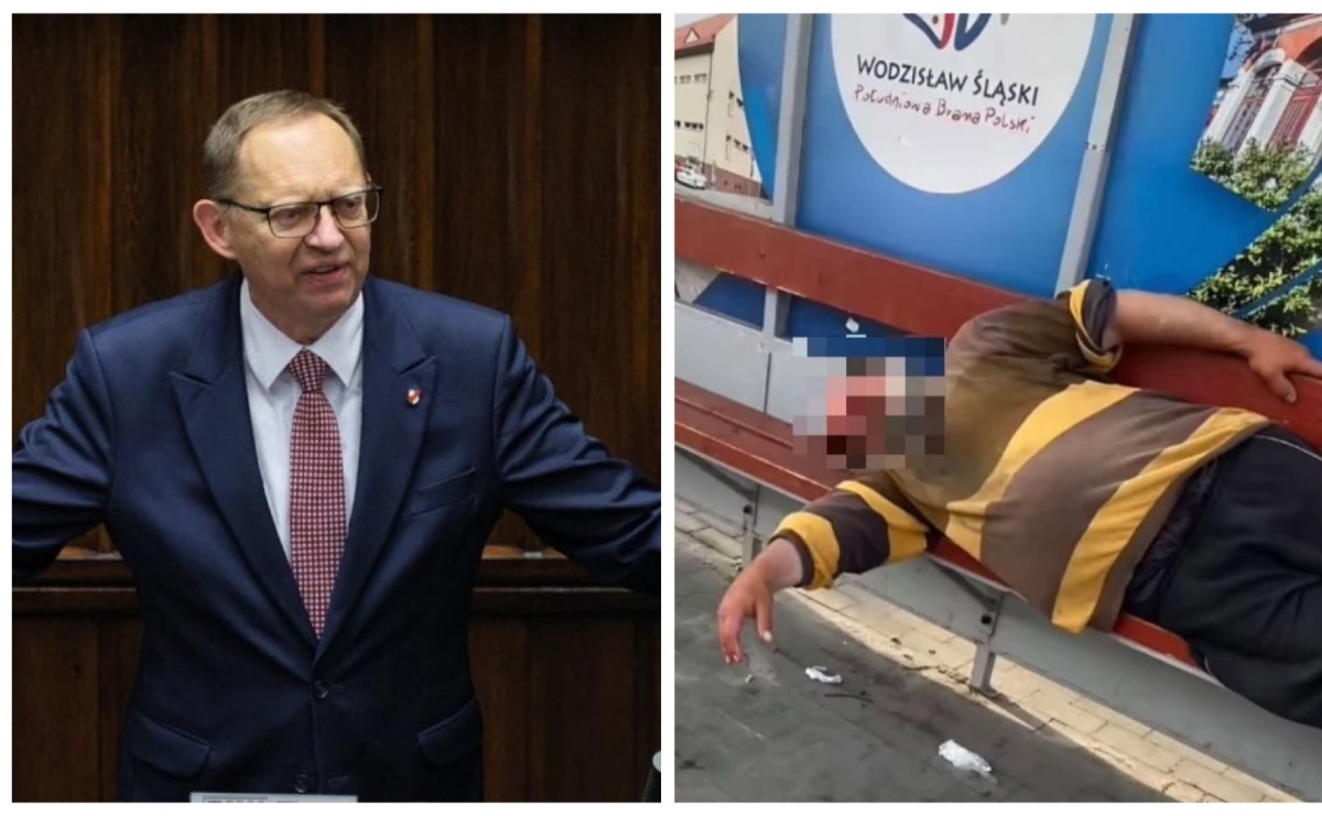Ministerstwo Zdrowia odpowiedziało w sprawie Bronka. Poseł Roman Fritz nie kryje rozczarowania - Serwis informacyjny z Raciborza - naszraciborz.pl